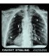 Idles – Caught Stealing (The Original Motion Picture Soundtrack) // LP, Bone White